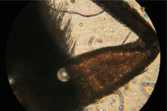 Anesthetica - Vrijdag & Zaterdag